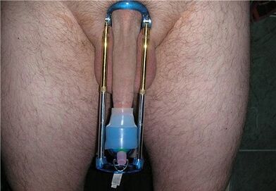 extensor para aumentar un miembro